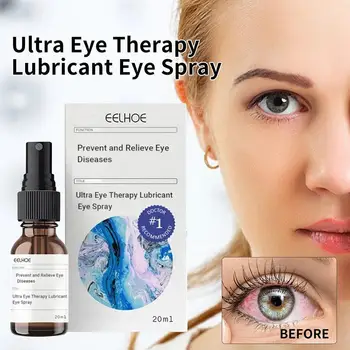 20 мл EYELIGHT Ultra Eye Therapy Gleitende Augentropfen Глазные Капли От Усталости, Устраняющие Сухость Глаз, Уход За Глазами, Снимающий Высокое качество L6V5